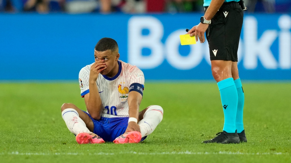 CEDERA KYLIAN MBAPPE MEMBUAT TIMNAS PERANCIS KHAWATIR